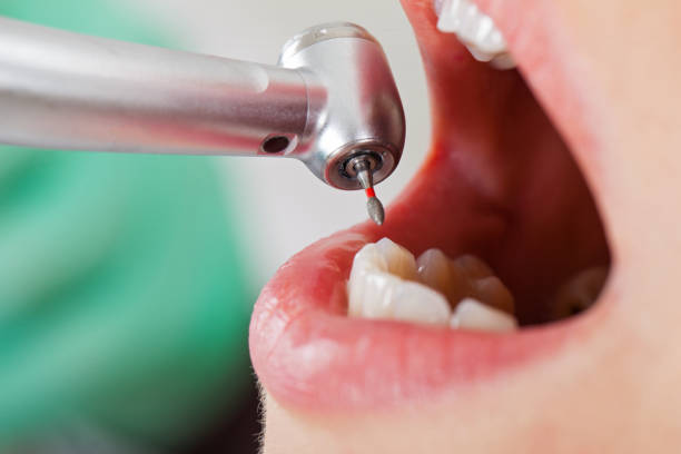 Best Knocked-Out Tooth Emergency  in Northvale, NJ